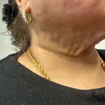 Dr. Sevil Klinik (Nişantaşı) Gıdı Ameliyatı Hüsranı!