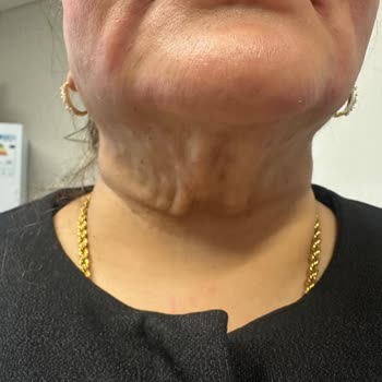 Dr. Sevil Klinik (Nişantaşı) Gıdı Ameliyatı Hüsranı!