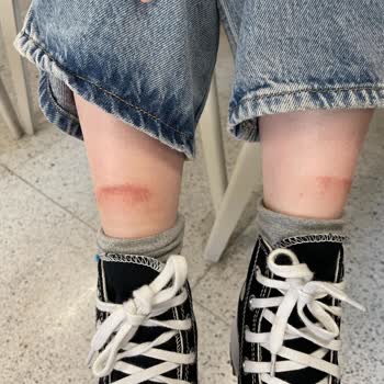 Tahriş Eden Tasarım: Converse Bot Hayal Kırıklığı