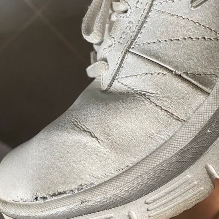 Sketchers Ayakkabının Kısa Ömürlü Olması Ve Müşteri Hizmetleri Sorunu
