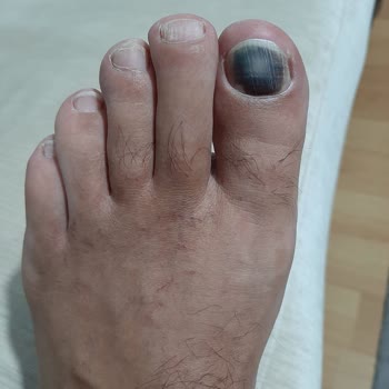 Hotiç Ayakkabılarında Kalite Sorunu