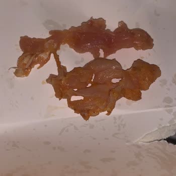 Hijyen Kurallarına Uymayan Restoran Tehlikesi