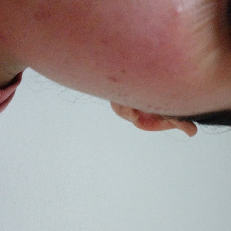 Softto Plus Keçi Sütü Sabunu İle Cilt Sorunları