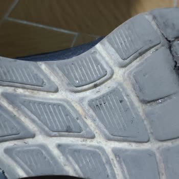 Skechers Ayakkabıda Kalitesizlik Ve Müşteri Memnuniyetsizliği