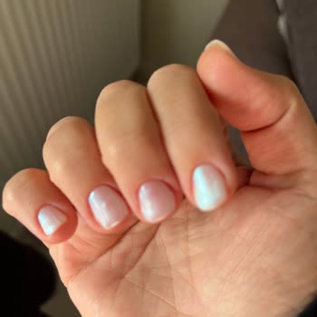 Randevu İhlali Ve İlgisiz Hizmet