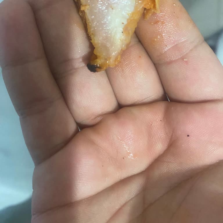 Eksik Sipariş Ve Çiğ Tavuk Şoku