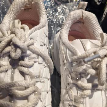 Skechers Ayakkabıda Beklenmedik Yıpranma Sorunu