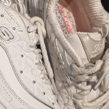 Skechers Ayakkabıda Beklenmedik Yıpranma Sorunu