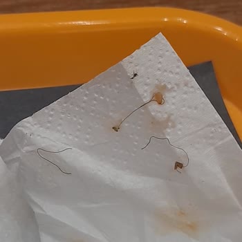 Makarnamdan Çıkan Kıllar Mide Bulandırdı