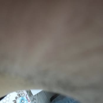 Livangel Güzellik Merkezi Lazerden Hiçbir Sonuç Alamadım