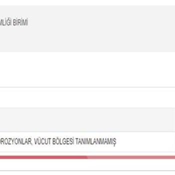 Bosch Fırın Camı Güvenlik Sorunu: Çocuğumda Yanıklara Sebep Oldu