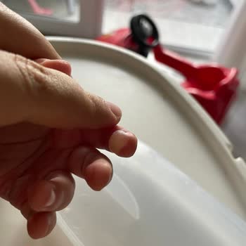 Bosch Fırın Camı Güvenlik Sorunu: Çocuğumda Yanıklara Sebep Oldu