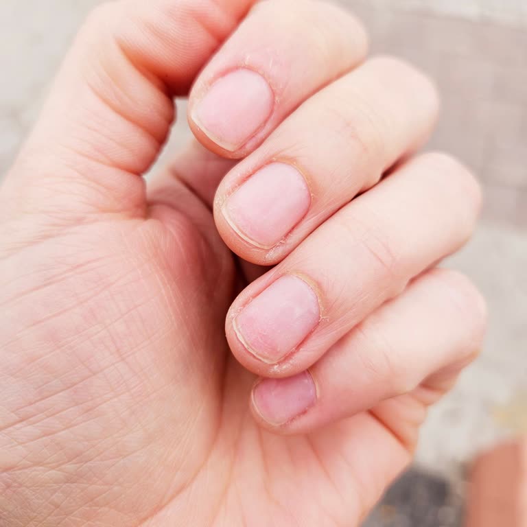 Gizem Yavuz Beauty Center Zaman Ve Para Kaybı