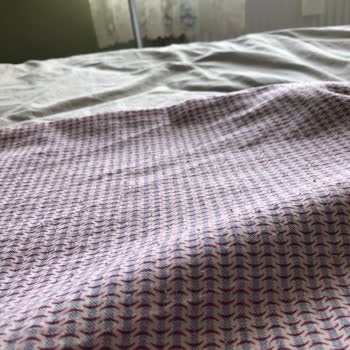 Madame Coco Nevresim Takımı Tüylenme Sorunu