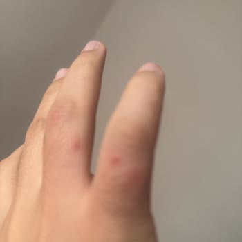 Sağlığımızı Tehlikeye Atan Ürünler Ve İlgisiz Müşteri Hizmetleri