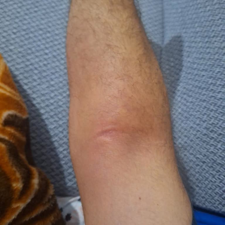 Hastanede Yaşanan Olumsuz Deneyim Ve Haksız Ücret Talebi