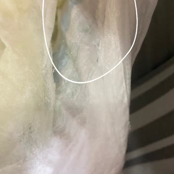 Defolu Bebek Bezi Sorunu