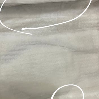 Defolu Bebek Bezi Sorunu