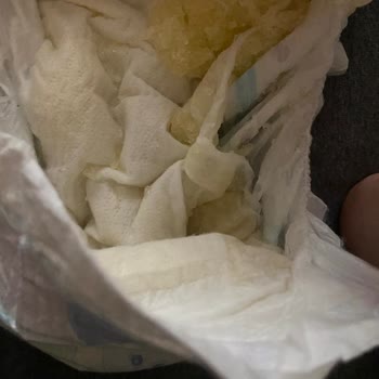 Defolu Bebek Bezi Sorunu