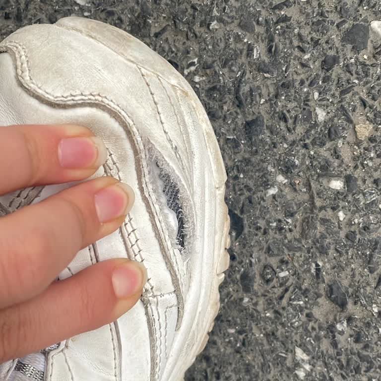 Skechers Ayakkabıda Hayal Kırıklığı: 5 Ayda Yıpranan Ürün Ve Müşteri Suçlaması