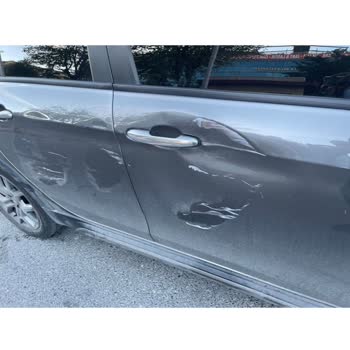 Türkiye Sigorta Kaza Sonrası Mağduriyet Yaşattı!