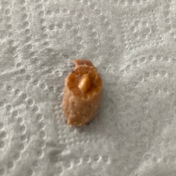 Kırık Çekirdekler Kahvaltı Keyfini Kaçırıyor