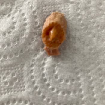 Kırık Çekirdekler Kahvaltı Keyfini Kaçırıyor