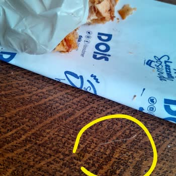 Yemeksepeti Siparişimde Yabancı Madde Şoku