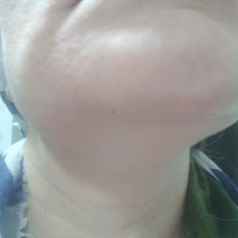 Loxxun Kozmetik İki Serum Bir Leke Karşıtı Krem Aldım Ama Hiç İşe Yaramadı