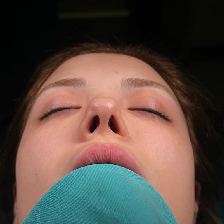 Başarısız Burun Ameliyatı Ve Saygısız Davranış