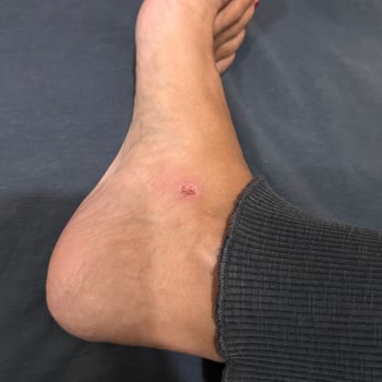 Ayakkabı İadesinde Müşteri Hizmetleri Sorunu