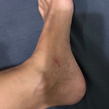 Ayakkabı İadesinde Müşteri Hizmetleri Sorunu