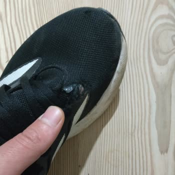 Adidas Ayakkabıda Sürekli Açılma Sorunu