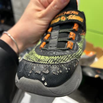 Skechers Çocuk Ayakkabısının Hızla Deformasyonu Ve Çözüm Eksikliği