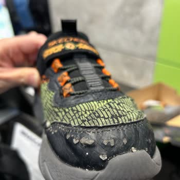 Skechers Çocuk Ayakkabısının Hızla Deformasyonu Ve Çözüm Eksikliği