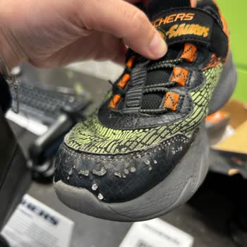 Skechers Çocuk Ayakkabısının Hızla Deformasyonu Ve Çözüm Eksikliği