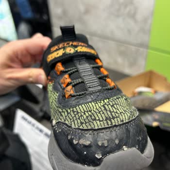 Skechers Çocuk Ayakkabısının Hızla Deformasyonu Ve Çözüm Eksikliği