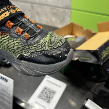 Skechers Çocuk Ayakkabısının Hızla Deformasyonu Ve Çözüm Eksikliği