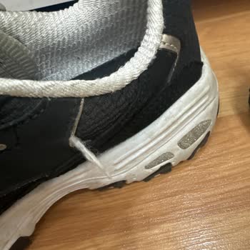 Skechers Ayakkabıda Kalite Sorunu Ve Yetersiz Müşteri Hizmeti