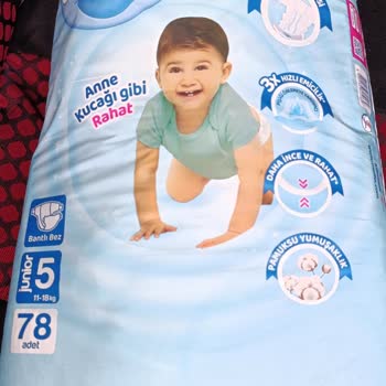 Molfix Bebek Bezi Küf Kokusu Şikayeti