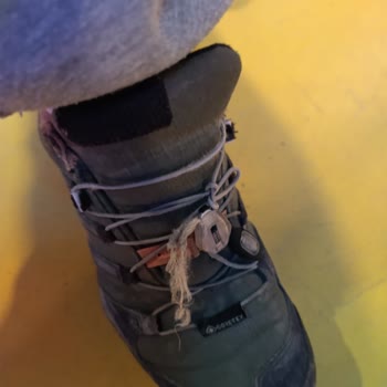 Adidas Ayakkabıda Bağcık Sorunu Ve Müşteri Hizmetleri Eksikliği