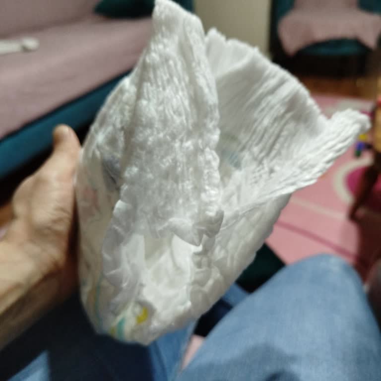 Molfix Külot Bezlerin Kalitesiz Bant Sorunu
