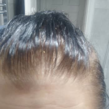 Koleston Beklenmedik Renk Değişimi Ve Mağduriyet