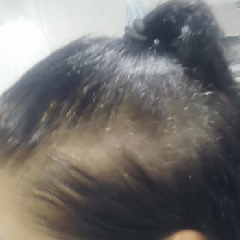 Koleston Beklenmedik Renk Değişimi Ve Mağduriyet