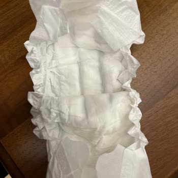 Sleepy Bebek Bezinde Üretim Hatası Ve Pişik Sorunu