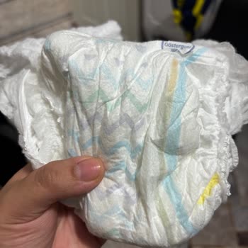 Molfix Bebek Bezi Emicilik Sorunu