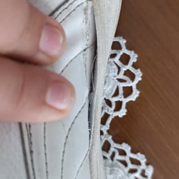 Puma Ayakkabının Beklenmedik Hasarı