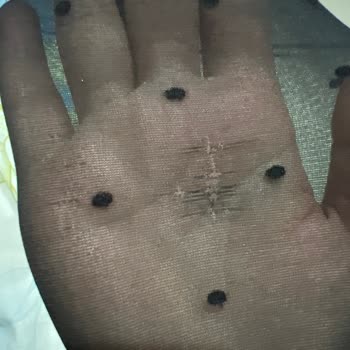 Penti Çorapların İlk Giyimde Yırtılması Şoku