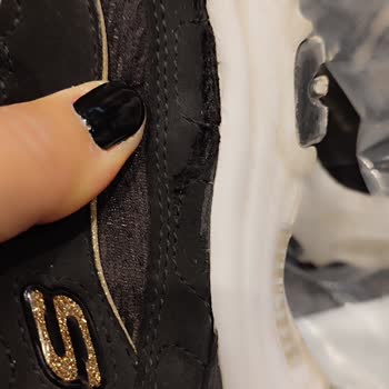 Skechers Ayakkabılarında Beklenmedik Yırtılma Sorunu