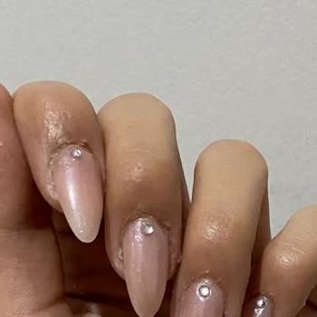 Hijyen Sorunu Ve Kalitesiz Hizmet